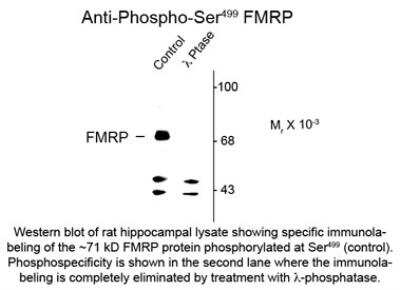 Western Blot: FMRP [p Ser499] Antibody [NBP2-29509]